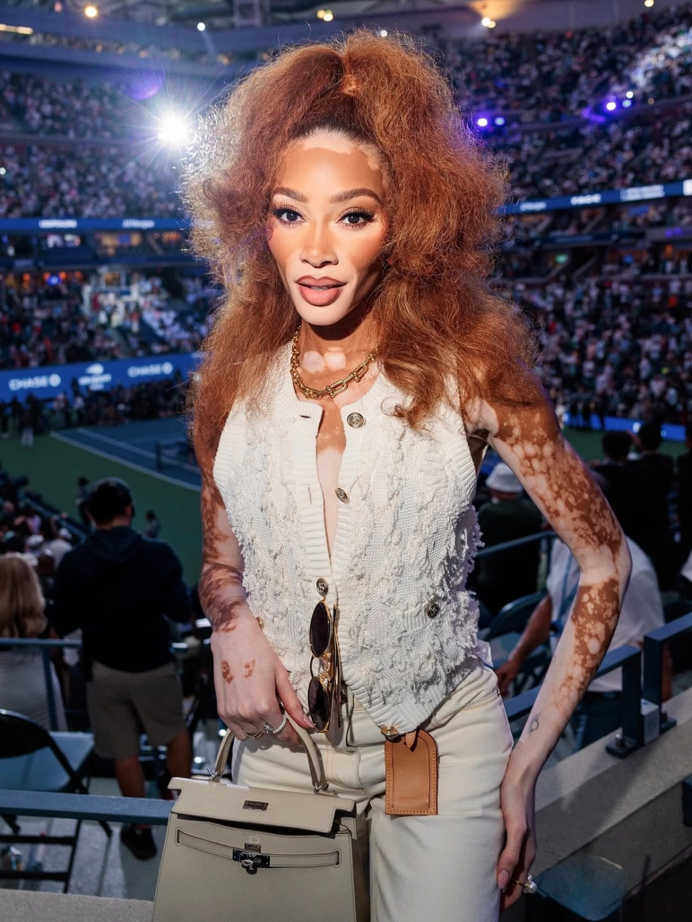 Winnie Harlow daughter (con gái) và những tin đồn về đời tư