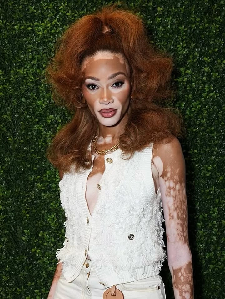 Winnie Harlow engagement ring và chiếc nhẫn đính hôn kim cương