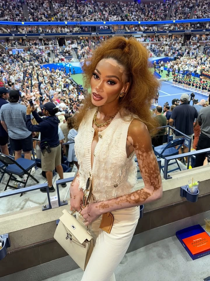 Winnie Harlow Kyle Kuzma và chuyện tình đẹp được ngưỡng mộ