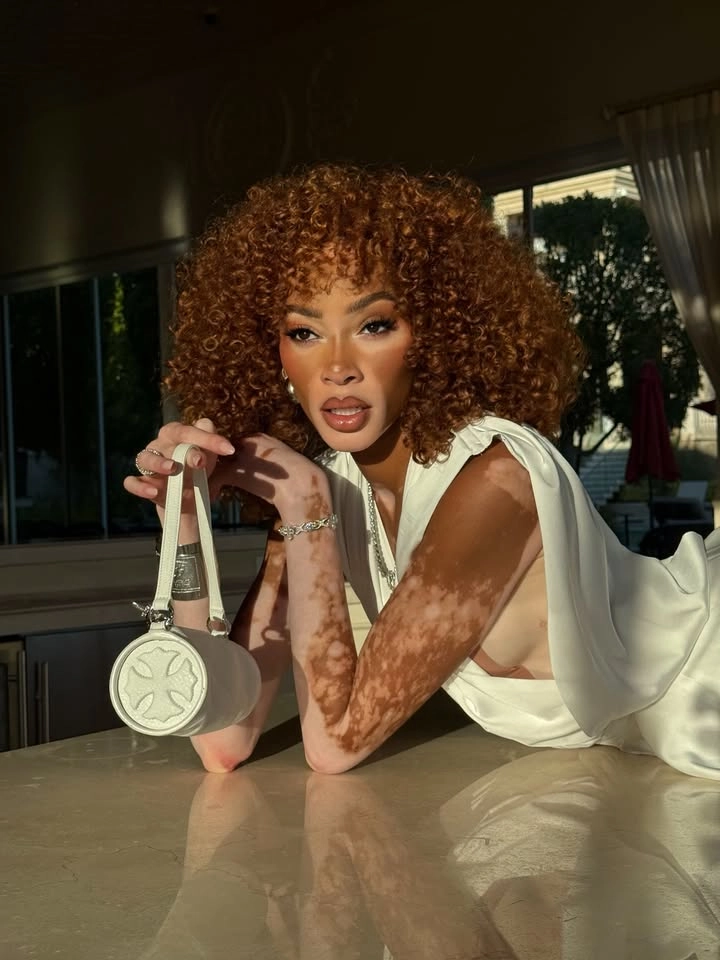 Winnie Harlow bf (bạn trai) và chuyện tình bên Kyle Kuzma