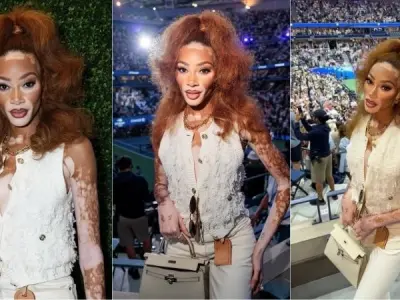 Hình ảnh Winnie Harlow rạng rỡ và phong cách cuốn hút