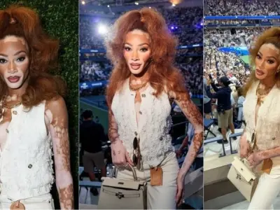 Hình ảnh Winnie Harlow rạng rỡ và phong cách cuốn hút